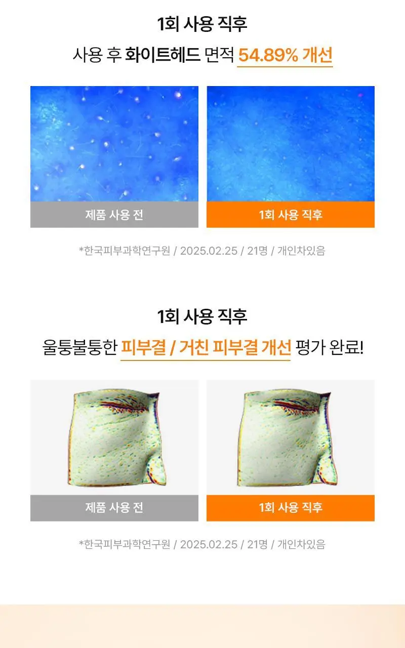 [퓨어디PICK/모공] 한스킨 딥 클렌징밤&블랙헤드 100ml 기획 (+15ml) 상세페이지 25